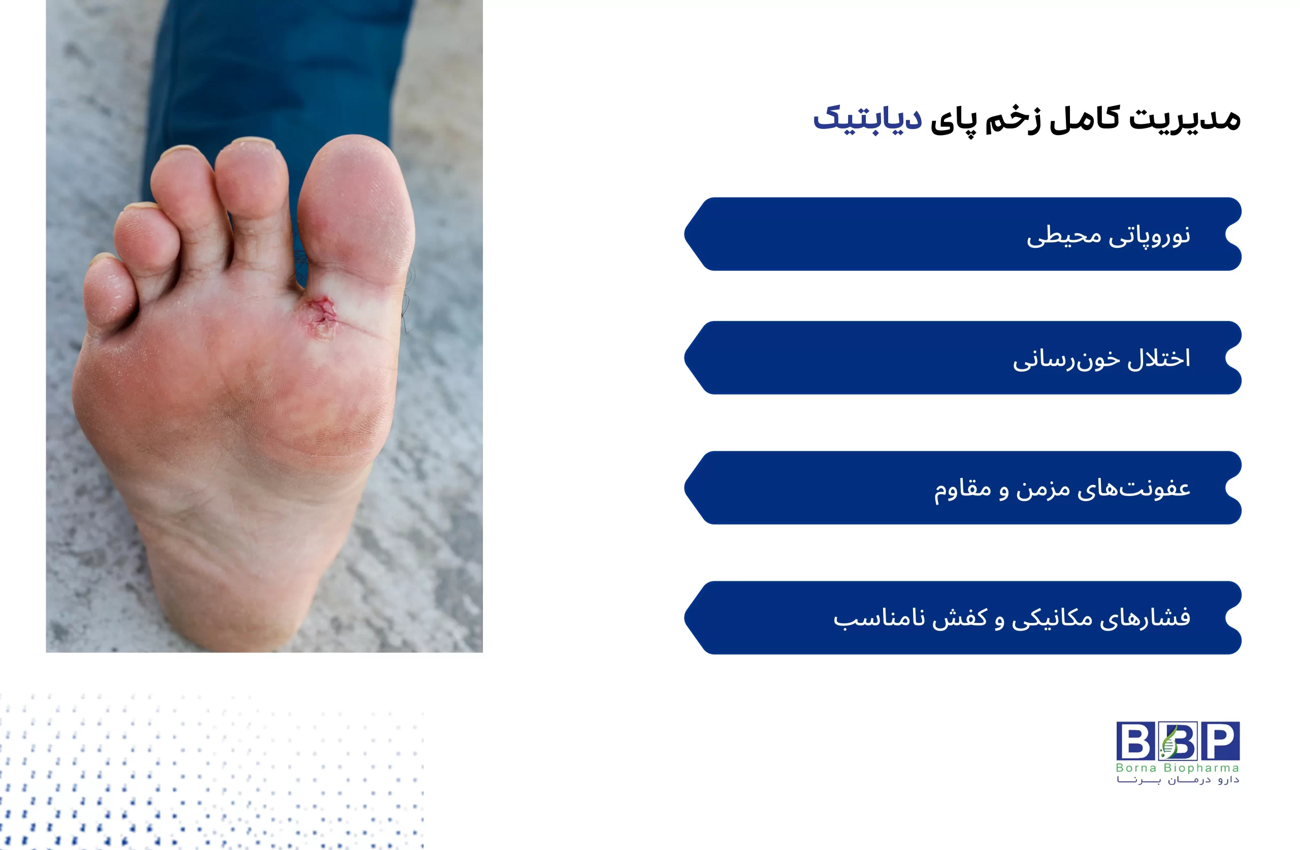 "راهنمای جامع پیشگیری، تشخیص و درمان زخم پای دیابتیک"