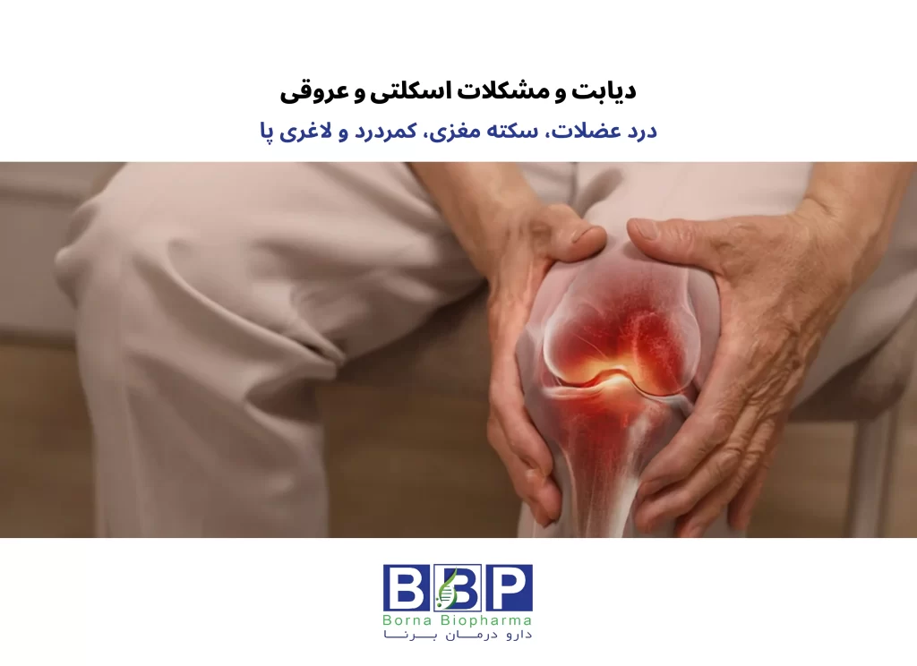 دیابت فقط قند خون نیست: مراقب عضلات، کمر، مغز و پاهای خود باشید بسیاری از افراد مبتلا به دیابت، تمام تمرکز خود را روی عدد قند خون میگذارند و غافل از اینکه این بیماری خاموش، آرامآرام به سایر قسمتهای بدن نیز آسیب میزند. درد عضلات، کمردرد مزمن، خطر سکته مغزی و لاغری پاها، چهار عارضه مهمی هستند که در صورت بیتوجهی، کیفیت زندگی را به شدت کاهش میدهند. در این راهنما، ساده و عملی با این عوارض آشنا میشوید. ۱. درد عضلات در دیابت: چرا و چه کنیم؟ چرا عضلات درد میگیرند؟ قند خون بالا به دو طریق به عضلات آسیب میزند: اول اینکه به اعصابی که عضلات را کنترل میکنند صدمه میزند (نوروپاتی)، دوم اینکه جریان خون را به عضلات کاهش میدهد. نتیجه: درد، گرفتگی، ضعف و خستگی زودرس. چه حسّی دارد؟ درد مبهم یا تیرکشنده در بازوها و پاها گرفتگی عضلات، مخصوصاً شبها مورمور شدن یا احساس سوزش در پاها ضعف هنگام راه رفتن یا بلند شدن از صندلی چه کار کنیم؟ کنترل قند خون: مهمترین قدم. قند متعادل = عضلات سالمتر. ورزش ملایم: پیادهروی، شنا، یوگا، تمرینات کششی. نیازی به ورزش سنگین نیست. مکملها: با نظر پزشک، ویتامین D، B12 و منیزیم میتوانند کمک کنند. ماساژ و فیزیوتراپی: برای کاهش سفتی و گرفتگی. آب کافی بنوشید: کمآبی گرفتگی را بدتر میکند. ۲. دیابت و سکته مغزی: خطری که نباید نادیده بگیرید چرا دیابتیها بیشتر سکته میکنند؟ قند بالا رگهای خونی را شکننده و چسبناک میکند. چربی و کلسترول به دیواره رگها میچسبد (تصلب شرایین)، رگ تنگ میشود و ممکن است لخته خون مسیر رسیدن خون به مغز را مسدود کند. علائم هشداردهنده (هر یک از اینها را جدی بگیرید): ضعف یا بیحسی ناگهانی در یک طرف صورت یا بدن اختلال در صحبت کردن یا فهمیدن حرف دیگران سردرد شدید و بیسابقه تاری دید یا دوبینی سرگیجه و از دست دادن تعادل اگر این علائم را دیدید، فوراً اورژانس بگیرید. هر دقیقه تأخیر = آسیب بیشتر به مغز. پیشگیری از سکته در دیابت: قند خون را در محدوده هدف نگه دارید فشار خون را کنترل کنید (کمتر از ۱۳۰/۸۰) کلسترول را پایین بیاورید (با رژیم و در صورت نیاز دارو) اگر سیگار میکشید، ترک کنید روزی ۳۰ دقیقه پیادهروی کنید ۳. دیابت و کمردرد: ارتباط پنهان آیا میدانستید دیابت میتواند باعث کمردرد شود؟ قند خون بالا باعث التهاب مزمن در بدن میشود. این التهاب به دیسکهای بین مهرههای کمر آسیب میزند و آنها را زودتر از موعد فرسوده میکند. همچنین اعصابی که به ستون فقرات خدمات میدهند، در اثر دیابت آسیب میبینند. راهکارهای کاهش کمردرد: قند خون را کنترل کنید (پایه همه چیز) ورزشهای مخصوص کمر: تمرینات کششی و تقویت عضلات شکم و پشت رژیم ضدالتهاب: ماهی، مغزها، سبزیجات، روغن زیتون – دور قندهای ساده خط بکشید فیزیوتراپی و ماساژ موقع نشستن و خوابیدن، وضعیت بدن را درست نگه دارید ۴. لاغری پا در دیابت: چرا پاها نازک میشوند؟ علت: دو عامل اصلی: اول، نوروپاتی دیابتی که باعث تحلیل عضلات پا میشود. دوم، کاهش جریان خون که مواد مغذی را به عضلات پا نمیرساند. نتیجه: پاها ضعیف، نازک و گاهی دردناک میشوند. همچنین خطر زخم پا و عفونت افزایش مییابد. چه باید کرد؟ ورزشهای مقاومتی سبک برای پاها (بلند کردن انگشتان پا، راه رفتن روی پنجه) کنترل قند خون معاینه روزانه پاها برای پیدا کردن زخمهای کوچک استفاده از کرمهای ترمیمکننده (مثل کرم برنامین دارای EGF و سیلور سولفادیازین) در صورت وجود زخم کفش مناسب بپوشید تا از فشار روی پا جلوگیری شود خلاصه طلایی برای بیماران دیابتی عارضه مهمترین اقدام پیشگیرانه درد عضلات ورزش منظم + کنترل قند سکته مغزی کنترل فشار خون و قند + ترک سیگار کمردرد تمرینات کششی + رژیم ضدالتهاب لاغری پا معاینه روزانه پا + ورزش مقاومتی سبک حرف آخر: دیابت یک بیماری همهجانبه است. اگر فقط به قند خون فکر کنید، بقیه قسمتهای بدن فراموش میشوند. عضلات، کمر، مغز و پاهای شما نیز به مراقبت نیاز دارند. با کنترل قند، ورزش روزانه، تغذیه سالم و چکاپهای منظم، میتوانید این عوارض را به تأخیر بیندازید یا حتی از آنها پیشگیری کنید.